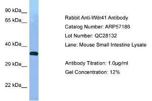 Western Blotting (WB) image for anti-WD Repeat Domain 41 (WDR41) (Middle Region) antibody (ABIN2787105)