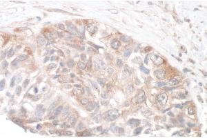 Immunohistochemistry (IHC) image for anti-RPTOR Independent Companion of mTOR, Complex 2 (RICTOR) (C-Term) antibody (ABIN7454633) (RICTOR anticorps  (C-Term))