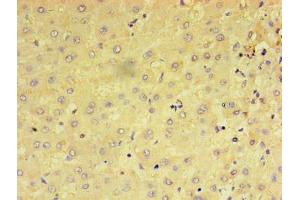 Immunohistochemistry of paraffin-embedded human liver tissue using ABIN7159237 at dilution of 1:100 (PRAME anticorps  (AA 1-509))