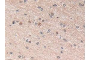 Detection of ADRM1 in Human Cerebrum Tissue using Polyclonal Antibody to Adhesion Regulating Molecule 1 (ADRM1) (ADRM1 anticorps  (AA 2-407))