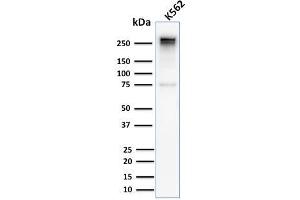 Western Blot Analysis of Human K562 cell lysate using Spectrin alpha 1 Rabbit Recombinant Monoclonal Antibody (SPTA1/2939R). (Recombinant SPTA1 anticorps  (AA 356-475))