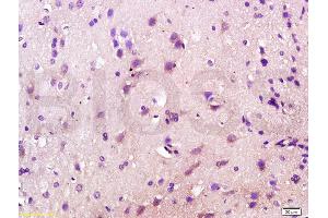 Formalin-fixed and paraffin embedded rat brain labeled with Anti-CD200R/Orexin receptor Polyclonal Antibody, Unconjugated (ABIN737586) at 1:200 followed by conjugation to the secondary antibody and DAB staining. (OX1R/OX2R anticorps  (AA 321-425))