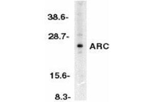 Western blot analysis of ARC in HeLa whole cell lysates with AP30077PU-N ARC antibody at 1/500 dilution. (NOL3 anticorps  (N-Term))