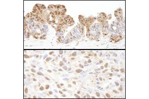 Immunohistochemistry (IHC) image for anti-Valosin Containing Protein (VCP) (AA 1-50) antibody (ABIN7454649)