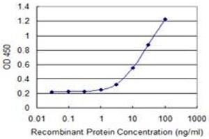 anti-Selenophosphate Synthetase 1 (SEPHS1) (AA 1-96) antibody