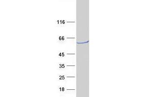 Validation with Western Blot