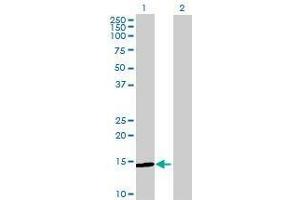 Lane 1: MGC16703 transfected lysate ( 16. (MGC16703 293T Cell Transient Overexpression Lysate(Denatured))