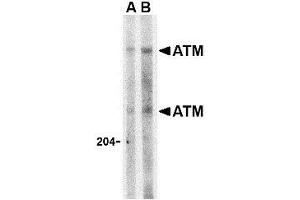 Western blot analysis of ATM in Daudi whole cell lysate with this product atM antibody at (A) 1 and (B) 2 μg/ml. (ATM anticorps  (C-Term))