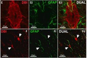 Confocal images showing labelling for DBI in ECL and GFAP+ glial fibers within lamina X of mouse spinal cord. (GFAP anticorps  (AA 411-422))