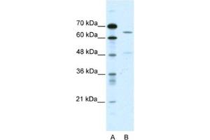 Western Blotting (WB) image for anti-Amiloride-Sensitive Cation Channel 1, Neuronal (ACCN1) antibody (ABIN2461090) (ACCN1 anticorps)