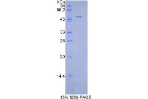 SDS-PAGE analysis of Mouse Peroxiredoxin 1 Protein.