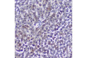 IHC analysis of CFP using anti-CFP antibody (ABIN6719298).
