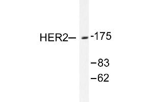 Image no. 1 for anti-Receptor tyrosine-protein kinase erbB-2 (ErbB2/Her2) antibody (ABIN265465) (ErbB2/Her2 anticorps)