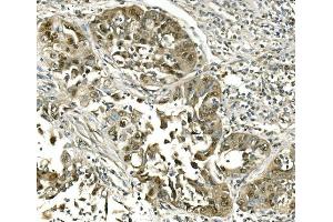 IHC analysis of Hsc70 using anti-Hsc70 antibody (ABIN7601962). (Hsc70 anticorps  (AA 520-614))