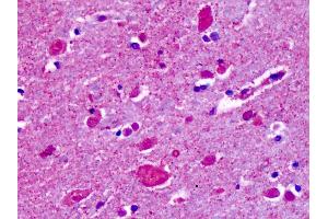 Anti-CELSR2 antibody IHC of human brain, cortex, cerebellum.