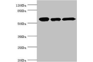 Western blot All lanes: CCT2 antibody at 5. (CCT2 anticorps  (AA 206-535))