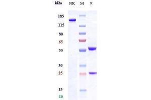 Anti-DPEP3 Reference Antibody (tamrintamab) on SDS-PAGE under reducing (R) condition.