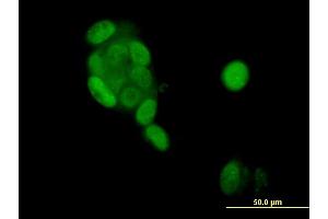 Immunofluorescence of monoclonal antibody to PGR on MCF-7 cell. (Progesterone Receptor anticorps  (AA 1-110))