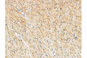 ABIN6256381 and ABIN6267092 at 1/100 staining Rat heart tissue by IHC-P. (TBC1D4 anticorps  (pSer588))