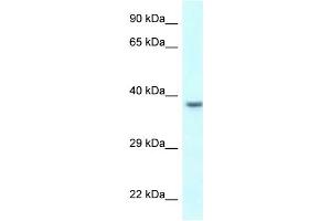 WB Suggested Anti-UPK3B Antibody Titration: 1. (Uroplakin 3B anticorps  (C-Term))