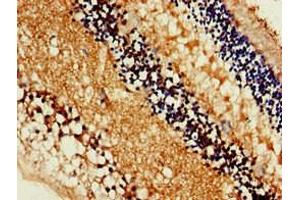 Immunohistochemistry of paraffin-embedded human eye tissue using ABIN7160169 at dilution of 1:100
