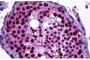 Human Testis: Formalin-Fixed, Paraffin-Embedded (FFPE) (DNMT3B anticorps  (AA 1-50))