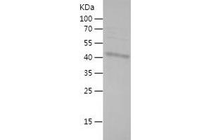 Western Blotting (WB) image for Zinc Finger, MYND-Type Containing 10 (ZMYND10) (AA 226-440) protein (His-IF2DI Tag) (ABIN7125813)