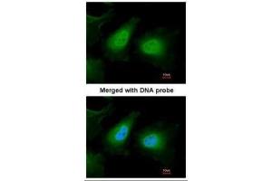 ICC/IF Image Immunofluorescence analysis of paraformaldehyde-fixed HeLa, using ULK2, antibody at 1:200 dilution.