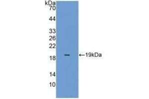 Detection of Recombinant PRDX5, Mouse using Polyclonal Antibody to Peroxiredoxin 5 (PRDX5)