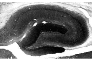 Adult rat hippocampus immunohistochemistry. (DLG3 anticorps  (AA 1-120))
