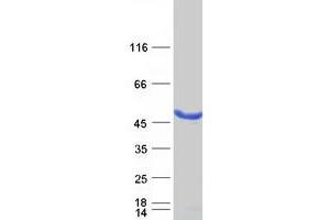 Validation with Western Blot