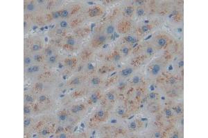Used in DAB staining on fromalin fixed paraffin- embedded liver tissue