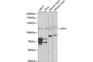 Western blot analysis of extracts of various cell lines, using WFS1 antibody (ABIN3022419, ABIN3022420, ABIN1513689, ABIN1514834 and ABIN6218806) at 1:1000 dilution. (WFS1 anticorps  (AA 1-285))