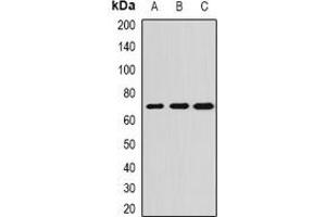 Western blot analysis of ALPPL2 expression in SKOV3 (A), HepG2 (B), mouse testis (C) whole cell lysates. (ALPPL2 anticorps)