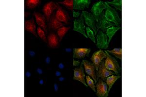 ABIN7094891 and ABIN7098944 staining  cells by IF/ICC. (PAG1 anticorps  (Internal Region))