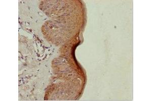 Immunohistochemistry of paraffin-embedded human skin tissue using ABIN7151057 at dilution of 1:100