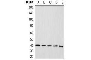 Western blot analysis of CD298 expression in HeLa (A), Jurkat (B), A431 (C), Raw264. (ATP1B3 anticorps  (Center))