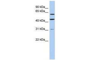 Image no. 1 for anti-Ring Finger Protein 112 (RNF112) (AA 466-515) antibody (ABIN6742431) (RNF112 anticorps  (AA 466-515))