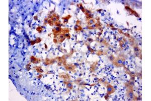 Paraformaldehyde-fixed, paraffin embedded rat liver cancer, Antigen retrieval by boiling in sodium citrate buffer (pH6. (C5orf51 anticorps)