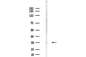 Western blot analysis of lysates from F10-LUC cells(heat-shock,45 min treatment), using OR4K2 Antibody at 1/1000 dilution.
