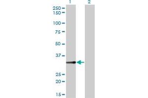 Western Blot analysis of BLVRA expression in transfected 293T cell line by BLVRA monoclonal antibody (M01), clone 4G4-2B6.