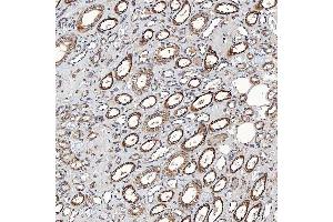 IHC analysis of SETD3 using anti-SETD3 antibody (ABIN7600293). (SETD3 anticorps  (AA 173-468))