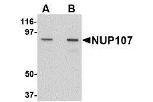 Image no. 1 for anti-Nucleoporin 107kDa (NUP107) (C-Term) antibody (ABIN342686) (NUP107 anticorps  (C-Term))