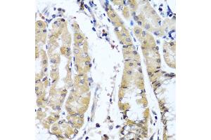 Immunohistochemistry of paraffin-embedded human stomach using COL9A1 antibody. (COL9A1 anticorps)