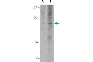 Western blot analysis of BBC3 expression in K-562 cell lysate with BBC3 monoclonal antibody, clone 10C5G1  at (A) 2. (PUMA anticorps  (AA 76-170))