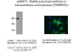 Image no. 1 for anti-Transmembrane Protease, Serine 3 (TMPRSS3) antibody (ABIN347032) (TMPRSS3 anticorps)