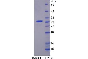 Image no. 1 for Cytoglobin (CYGB) (AA 1-190) protein (His tag) (ABIN6236873)