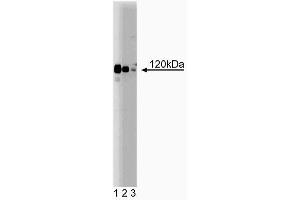 Western blot analysis of PRK1 on Jurkat lysate. (PKN1 anticorps  (AA 215-388))