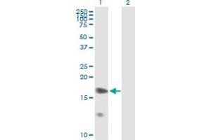 Western Blot analysis of PPP1R7 expression in transfected 293T cell line by PPP1R7 MaxPab polyclonal antibody. (PPP1R7 anticorps  (AA 1-360))