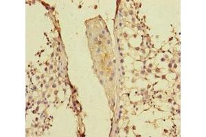 Immunohistochemistry of paraffin-embedded human testis tissue using ABIN7158455 at dilution of 1:100 (PPFIA1 anticorps  (AA 660-800))